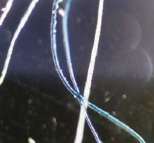 Morgellons... νανορομπότ στον ανθρώπινο οργανισμό;