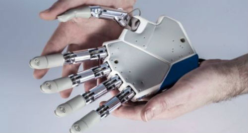 Bionic-hand