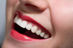 Οι πέντε χειρότερες τροφές για τα δόντια σας