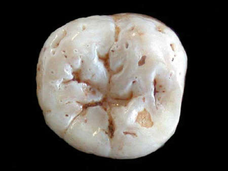 Εύρημα 40.000 ετών Ένα δόντι από το Γύθειο αποκαλύπτει τις μετακινήσεις των Νεάντερταλ
